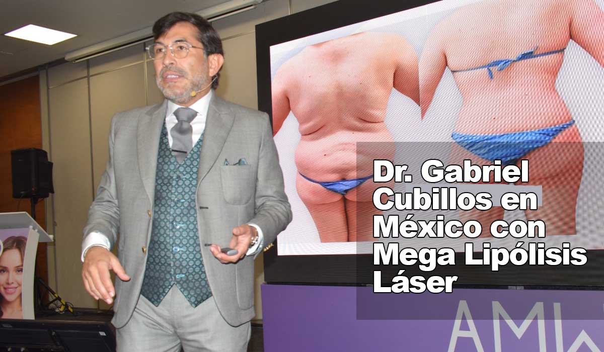 Dr Cubillosen México con Mega Lipólisis Láser
